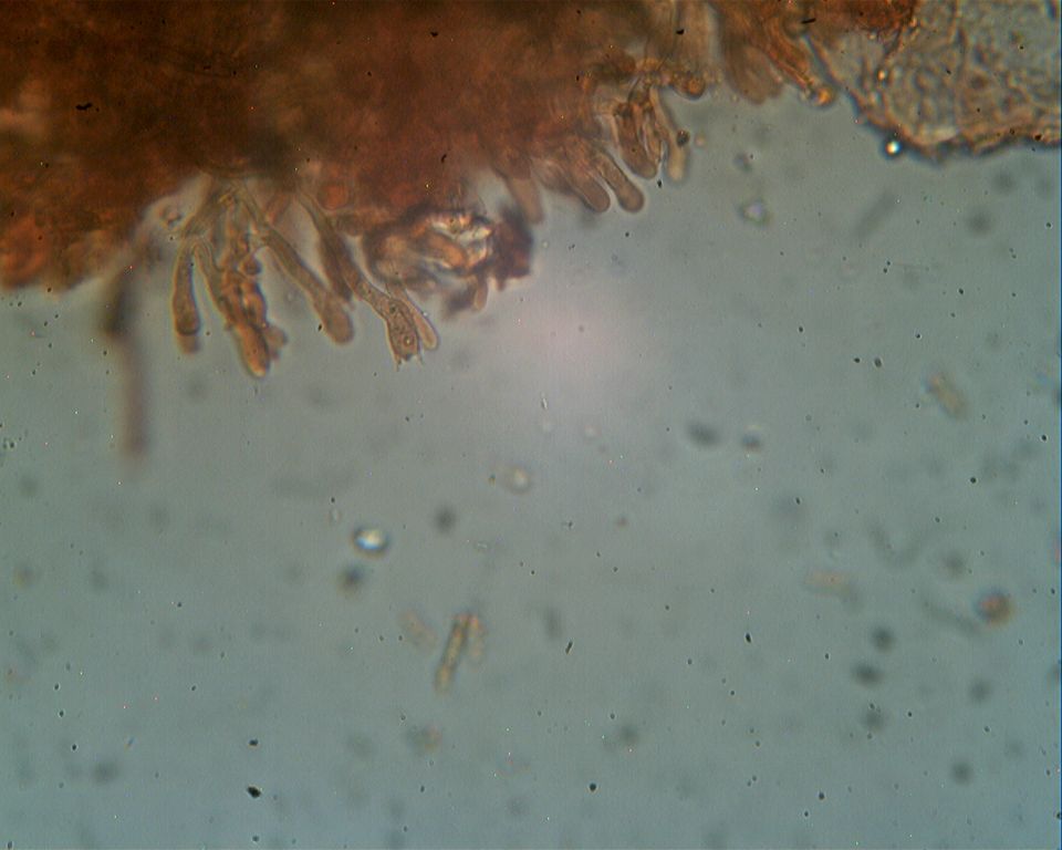 Corticiacea ospitale